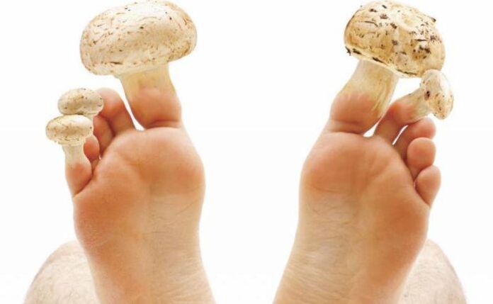 causas, síntomas e tratamento do fungo do pé