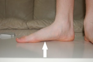 pés chat causa